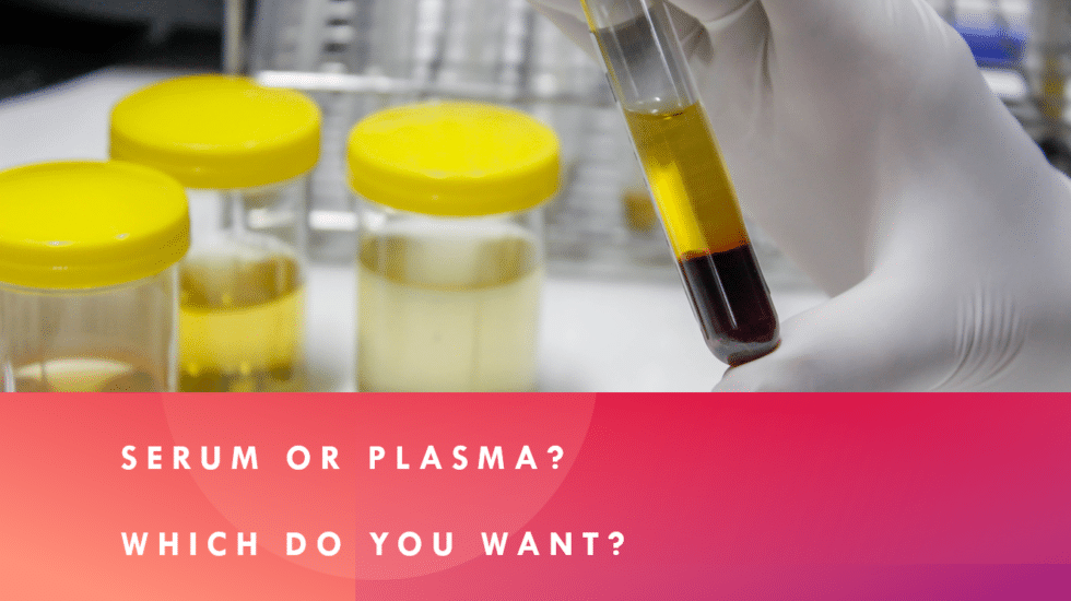 Serum vs Plasma: Key Differences for Research & Diagnostic Use